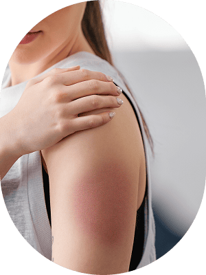 慢性的な皮膚炎