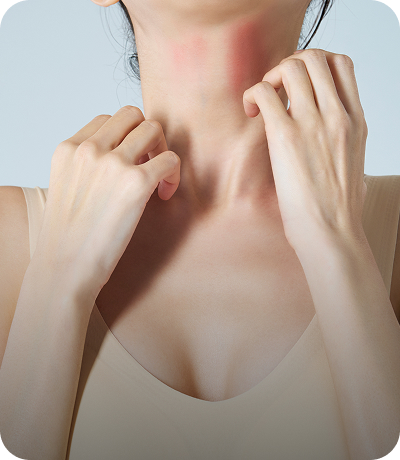 K-スキンケア治療